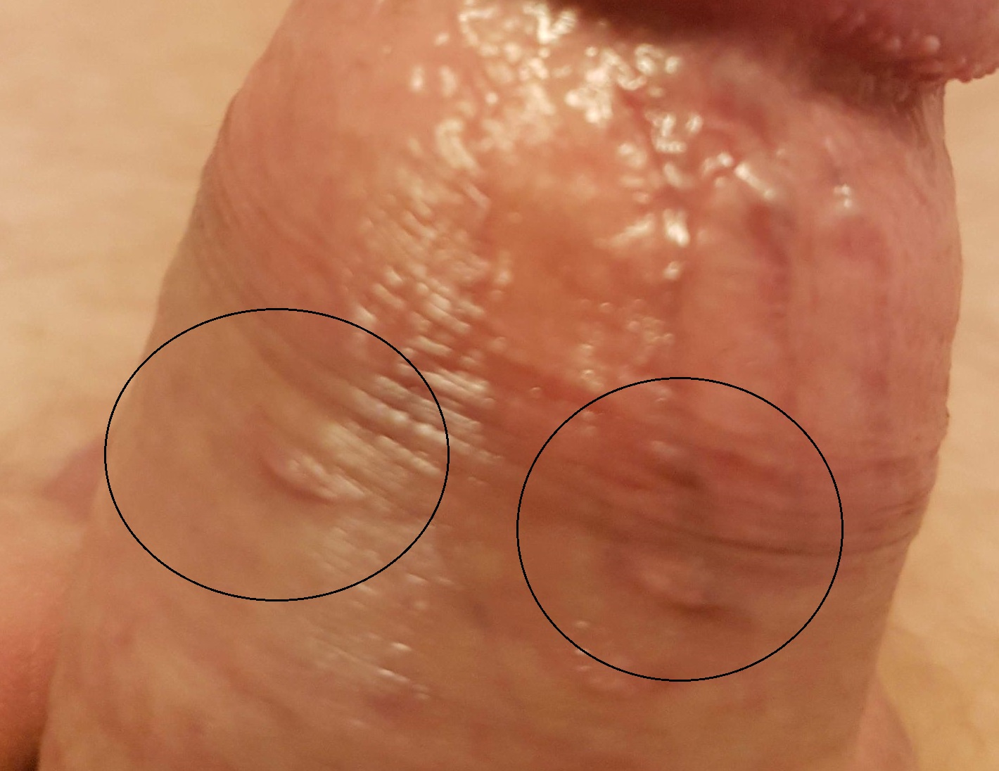 Nikvorm bio vitalitás, Természetes gyógymódok hüvelygomba ellen - HáziPatika