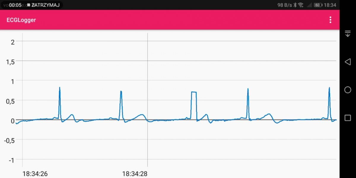 ecg with polar h10